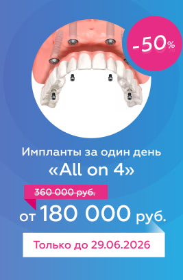 Импланты за один день «All on 4»