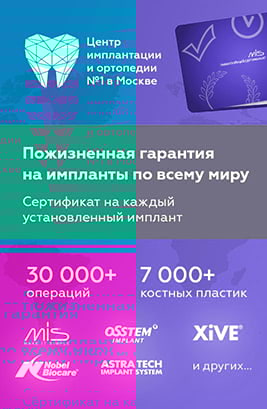 Пожизненная гарантия