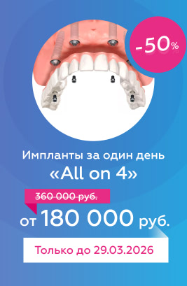 Импланты за один день «All on 4»