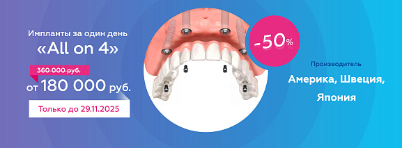 Импланты за один день "All on 4">