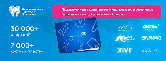 Пожизненная гарантия на импланты по всему миру>