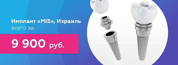 Установка имплантата MIS>
