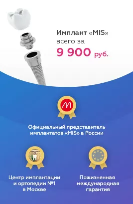 Имплант MIS